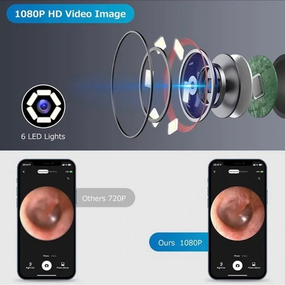 Ear Wax Removal, Ear Cleaner Camera with 1080P, 6 Ear Pick, 8 Pcs Ear Set White - Picture 2 of 8